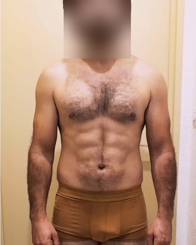 Après, de face, visage flouté